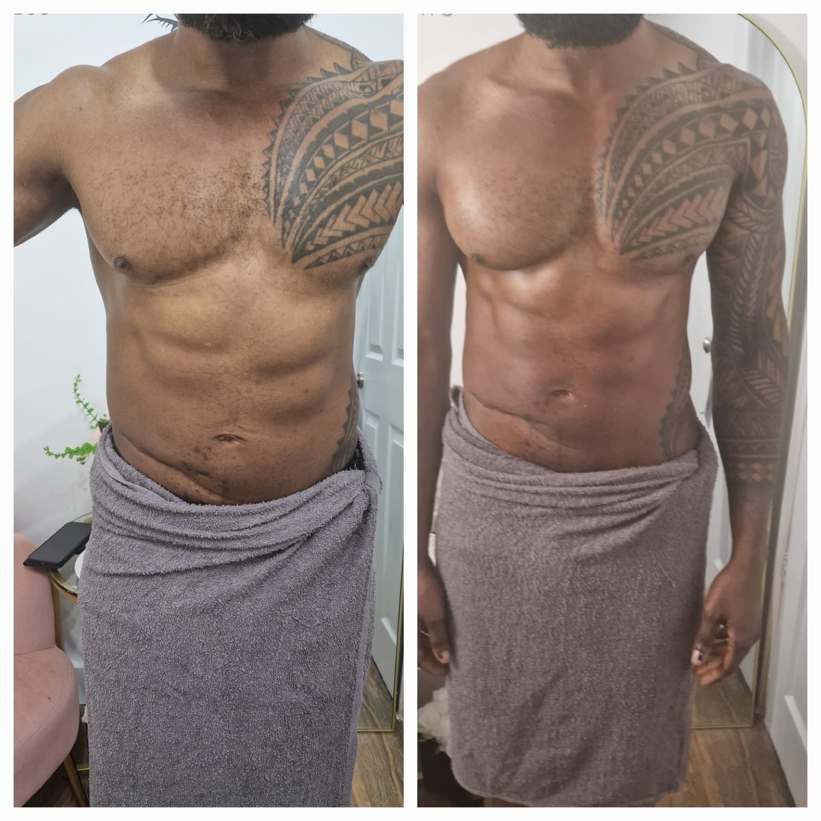 client after powersculpt treatment